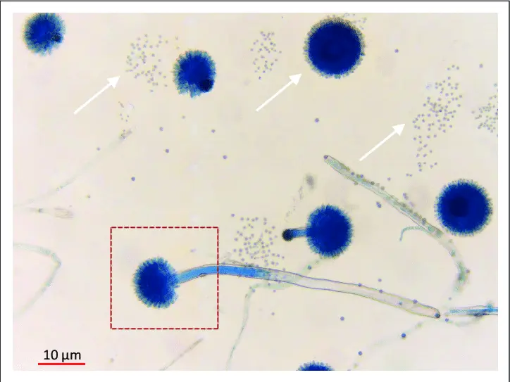 Aspergillus