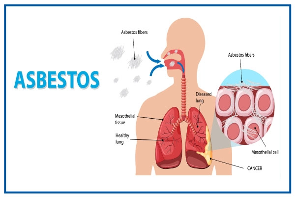 What Measures Can Prevent Asbestos-Related Health Risks?  